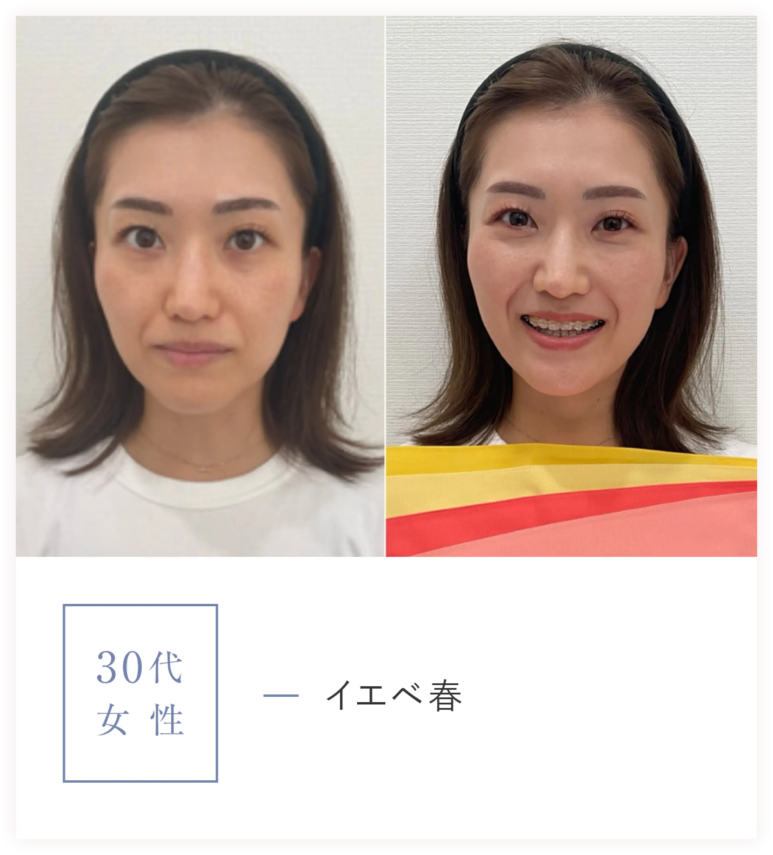 30代女性/イエベ春